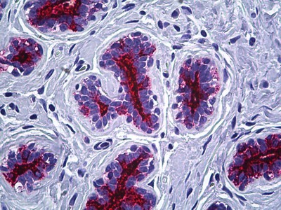 MUC1 Antibody