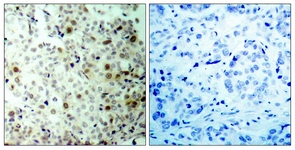 CDK2 (Phospho-Thr160) antibody