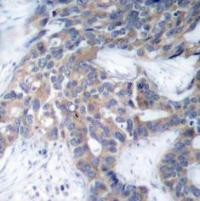MEK1 / MEK2 (phospho Ser217 / Ser221) Antibody