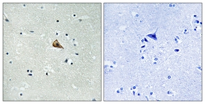 Trk A (Phospho-Tyr701) antibody