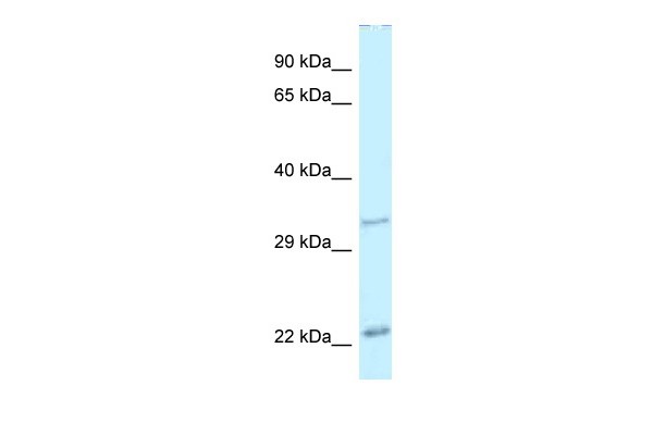 Pdx1 antibody - N-terminal region