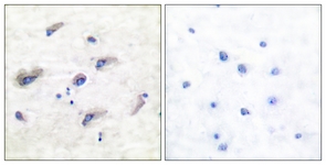 Tau (Phospho-Ser356) antibody