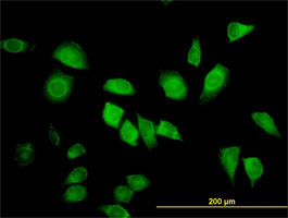 LZTFL1 Antibody (monoclonal) (M01)