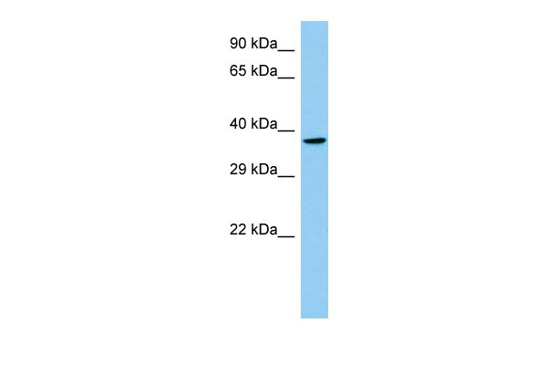 Lhx8 Antibody