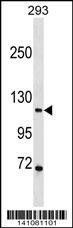PGR/PR Antibody