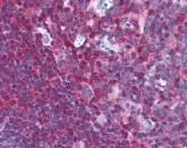 NFKB1 Antibody