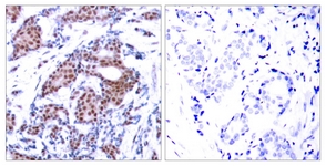 Elk1 (Phospho-Ser383) antibody