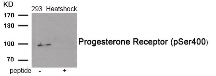 Progesterone Receptor (phospho Ser400) Antibody