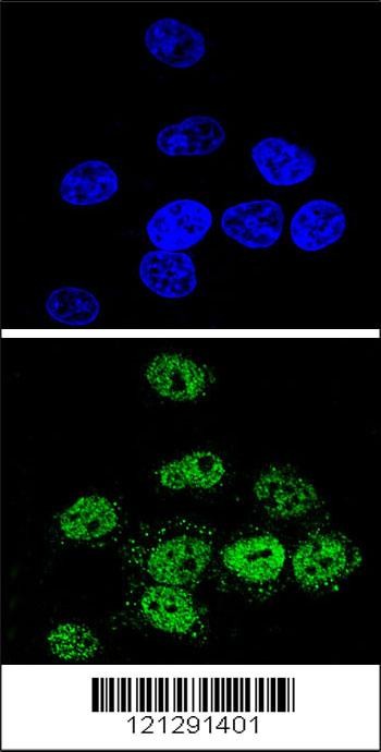 MEF2A Antibody