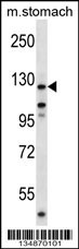 Mouse Ptk2 Antibody