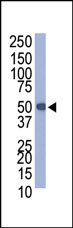 Protein-C Tag Antibody