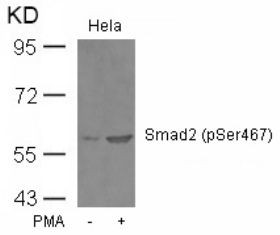 Smad2 (phospho Ser467) Antibody