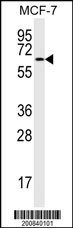 MAP2 Antibody (Ascites)