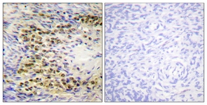 Akt (Phospho-Thr72) antibody