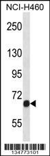 Mouse Fgfr1 Antibody
