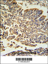 HSP27 Antibody