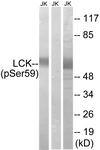LCK (Phospho-Ser59) antibody