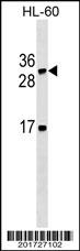 LTB Antibody (C-term)