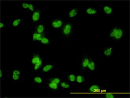 MED31 Antibody (monoclonal) (M01)