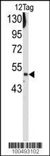 FLAG tag antibody (DYKDDDDK)