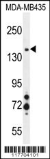 MET Antibody