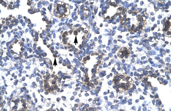 FOXA3 antibody - middle region