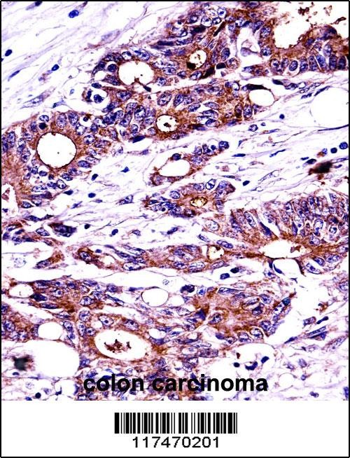 NPM1 Antibody