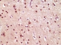 ELK1 Antibody