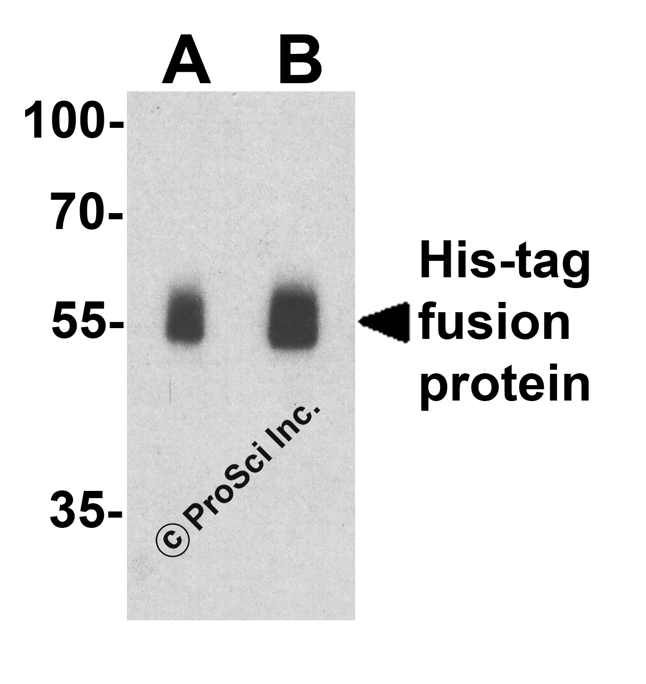 His-tag Antibody