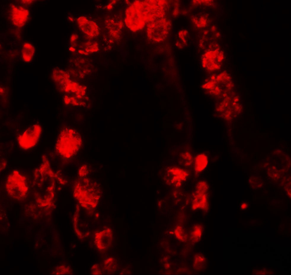 STAT3 Antibody
