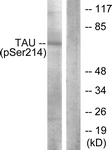 Tau (Phospho-Ser214) antibody