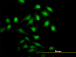 NME1 Antibody (monoclonal) (M01)