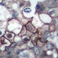 EGFR (phospho Tyr1197) Antibody