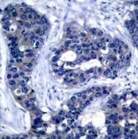 IRS 1 (phospho Ser639) Antibody