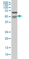 NOVA1 Antibody (monoclonal) (M07)