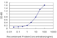 MCCC1 Antibody (monoclonal) (M01)