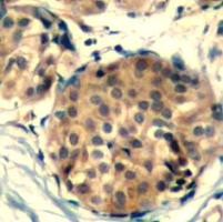 c kit Antibody
