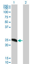 MGC16186 Antibody (monoclonal) (M02)