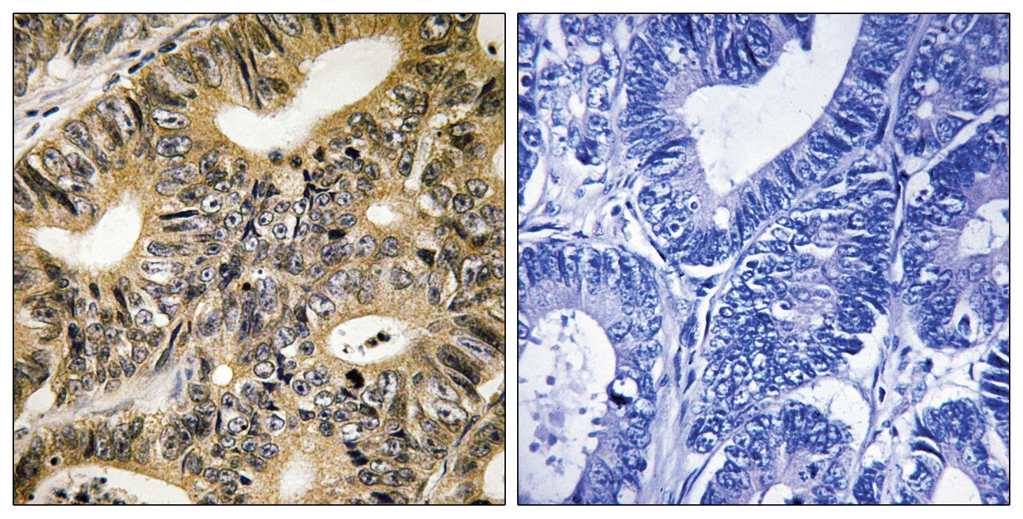 4E-BP1 (phospho Thr70) Antibody