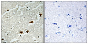 NF-kappaB p65 antibody