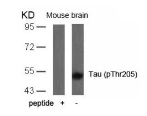 Tau (phospho Thr205) Antibody
