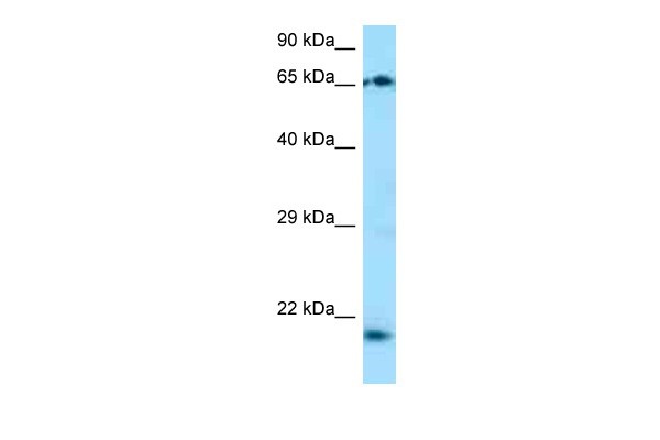 TP73-AS1 antibody - C-terminal region