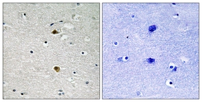 NF-kappaB p65 antibody