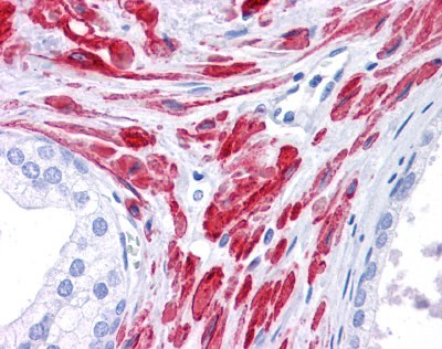 Stat5b antibody - C-terminal region