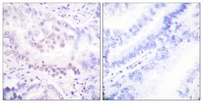 AML1 (Phospho-Ser303) antibody