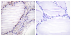Fos (Phospho-Ser362) antibody