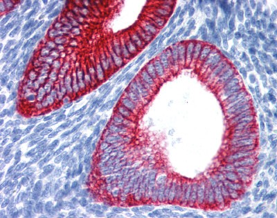 KRT19 Antibody, Monoclonal