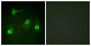 NF-kappaB p65 (Acetyl-Lys310) antibody