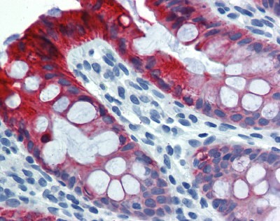 Cytoke Antibody
