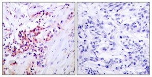 NF-kappaB p65 (Phospho-Ser468) antibody